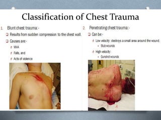 Classification of Chest Trauma
 