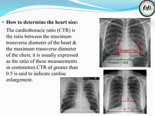 Chest 2_b3ca9e62dffa3e038b60dddc8be8f96c.pdf