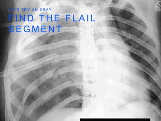 F I N D T H E F L A I L
S E G M E N T
L E T S T R Y A N X R A Y
 