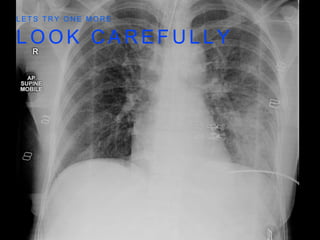 L O O K C A R E F U L L Y
L E T S T R Y O N E M O R E
 