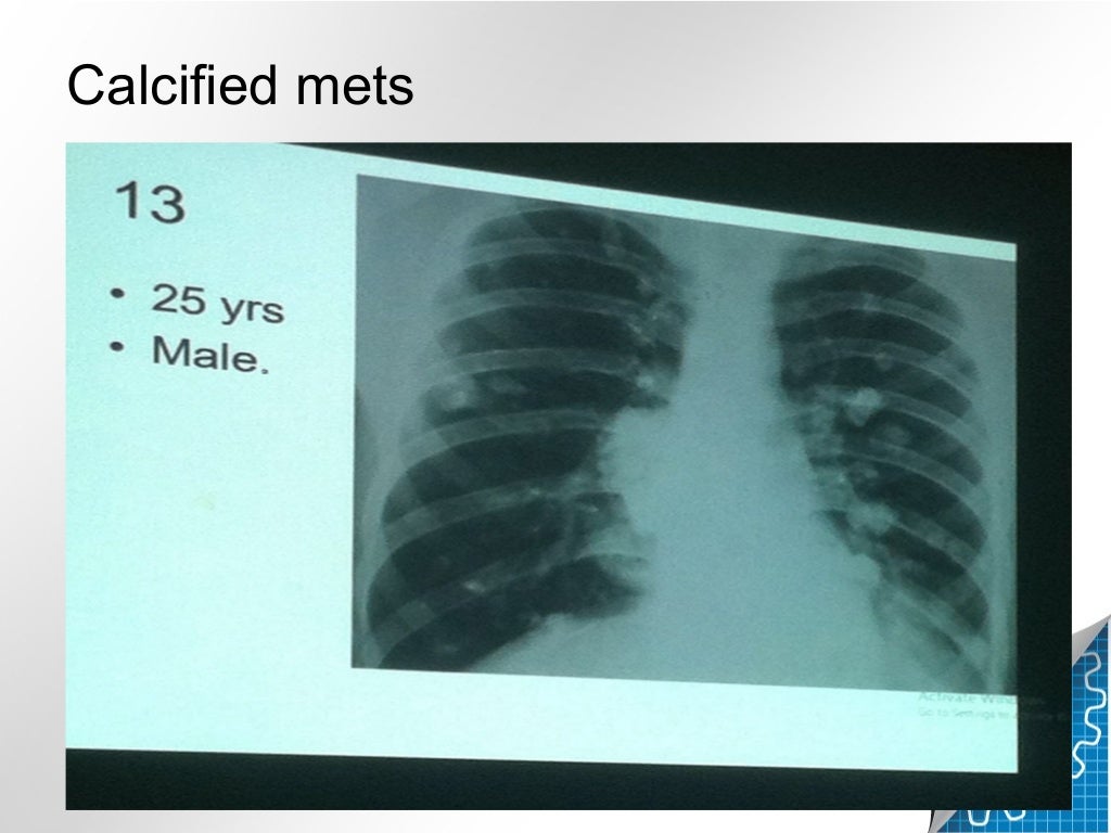 Chest and cvs radiology mocks fcps
