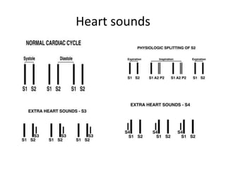 Heart sounds 
 