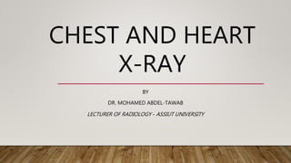 CHEST AND HEART
X-RAY
BY
DR. MOHAMED ABDEL-TAWAB
LECTURER OF RADIOLOGY - ASSIUT UNIVERSITY
 