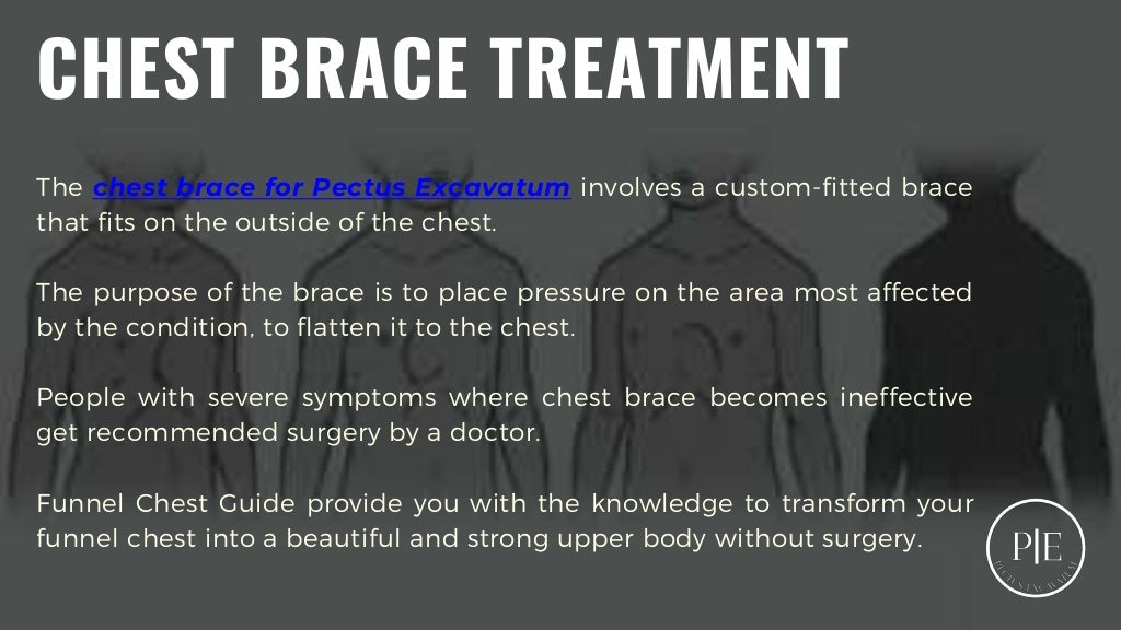 Chest Brace for Pectus Excavatum Funnel Chest Guide