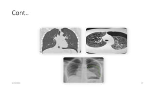 CHEST CONDITION-DCM 2021.pptx