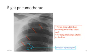 CHEST CONDITION-DCM 2021.pptx