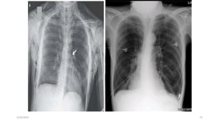 CHEST CONDITION-DCM 2021.pptx