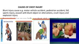 CHEST CONDITION-DCM 2021.pptx
