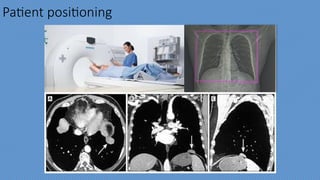 CHEST CT SCAN PRESENTATION FOR NEW RADIOGRAPHERS AND CT SCAN ...