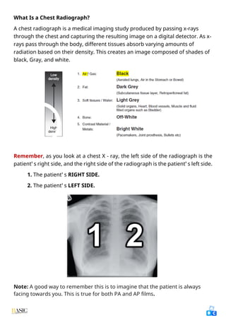 Comprehensive Clinical Guide to Chest X-Ray Interpretation and Anatomy ...