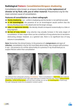Comprehensive Clinical Guide to Chest X-Ray Interpretation and Anatomy ...