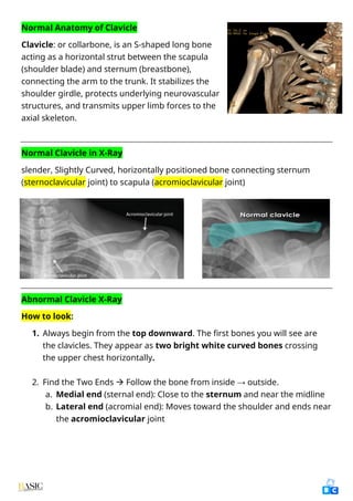 Comprehensive Clinical Guide to Chest X-Ray Interpretation and Anatomy ...