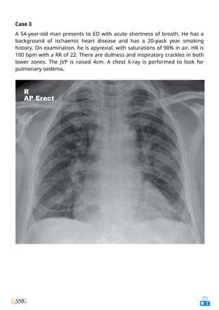 Comprehensive Clinical Guide to Chest X-Ray Interpretation and Anatomy ...