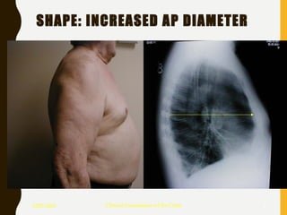 Chest examination | PPT