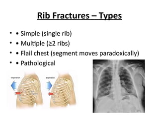 Chest Fractures - Chinaraj Maharanda Jishanth Kumar.pptx