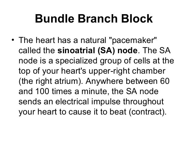 Natural Treatment For Right Bundle Branch Block Natural Treatment For Right Bundle Branch Block
