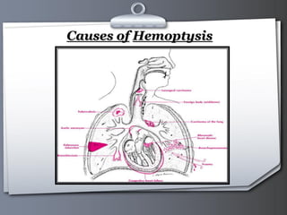 Your Logo Page 20
Causes of Hemoptysis
 
