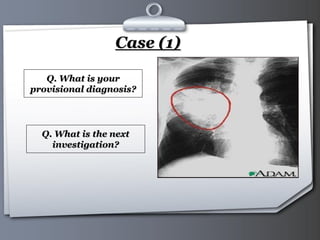 Your Logo Page 36
Case (1)
Q. What is your
provisional diagnosis?
Q. What is the next
investigation?
 