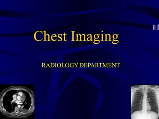 Chest Imaging
 RADIOLOGY DEPARTMENT
 