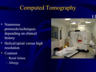 Computed Tomography

• Numerous
  protocols/techniques
  depending on clinical
  history
• Helical/spiral versus high
  resolution
• Contrast
   – Renal failure
   – Allergy
 