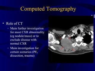 Computed Tomography

• Role of CT
  – Main further investigation
    for most CXR abnormality
    (eg nodule/mass) or to
    exclude disease with
    normal CXR
  – Main investigation for
    certain scenarios (PE,
    dissection, trauma)
 