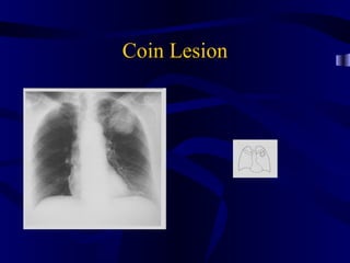 Coin Lesion
 