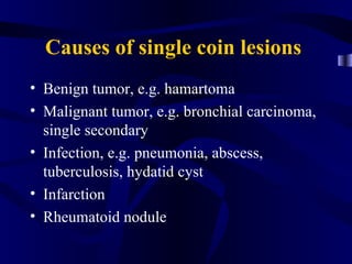 Causes of single coin lesions
• Benign tumor, e.g. hamartoma
• Malignant tumor, e.g. bronchial carcinoma,
  single secondary
• Infection, e.g. pneumonia, abscess,
  tuberculosis, hydatid cyst
• Infarction
• Rheumatoid nodule
 