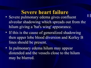 Severe heart failure
• Severe pulmonary edema gives confluent
  alveolar shadowing which spreads out from the
  hilum giving a 'bat's wing' appearance.
• If this is the cause of generalized shadowing
  then upper lobe blood diversion and Kerley B
  lines should be present.
• In pulmonary edema hilum may appear
  distended and the vessels close to the hilum
  may be blurred.
 