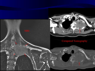 MRI


      Computed Tomography
 