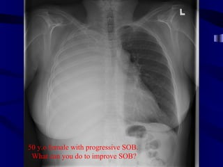 50 y.o female with progressive SOB.
 What can you do to improve SOB?
 