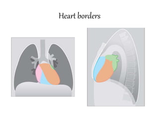 Chest imaging | PPTX