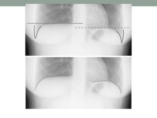 Chest imaging | PPT