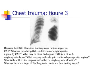 CHEST IMAGING deataied lecture on Radiological investigations of the ...