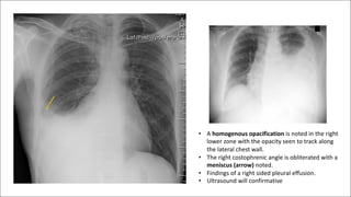 Chest imaging part one radiology lecture .pdf