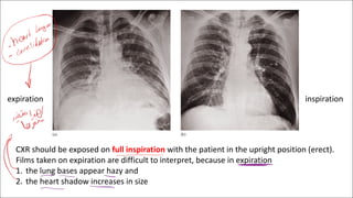 Chest imaging part one radiology lecture .pdf