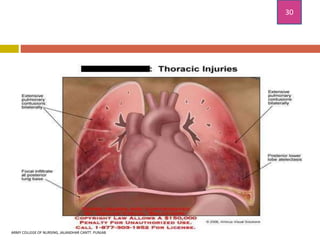 chest injuries and its treatment and nursing management .pptx
