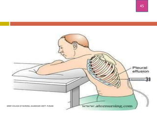 Chest Spring Positive chest injuries and its treatment and nursing management .pptx