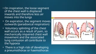 chest injuries chest injuries chest injuries.pptx