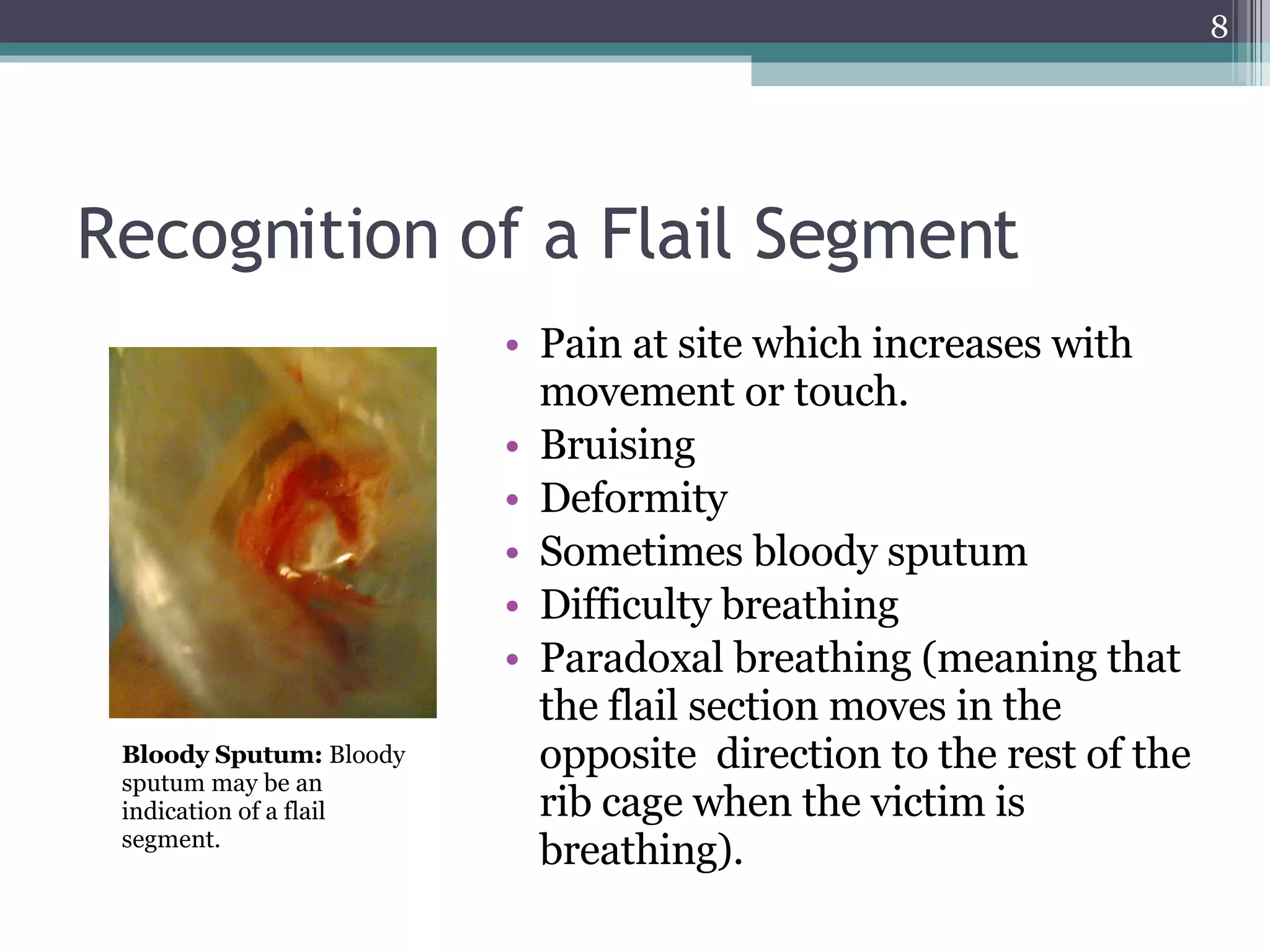 Chest Injuries | PPT