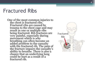 Chest Injuries | PPT