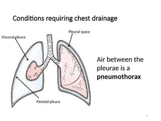 45
Conditions requiring chest drainage
Air between the
pleurae is a
pneumothorax
Pleural space
Visceral pleura
Parietal pleura
 