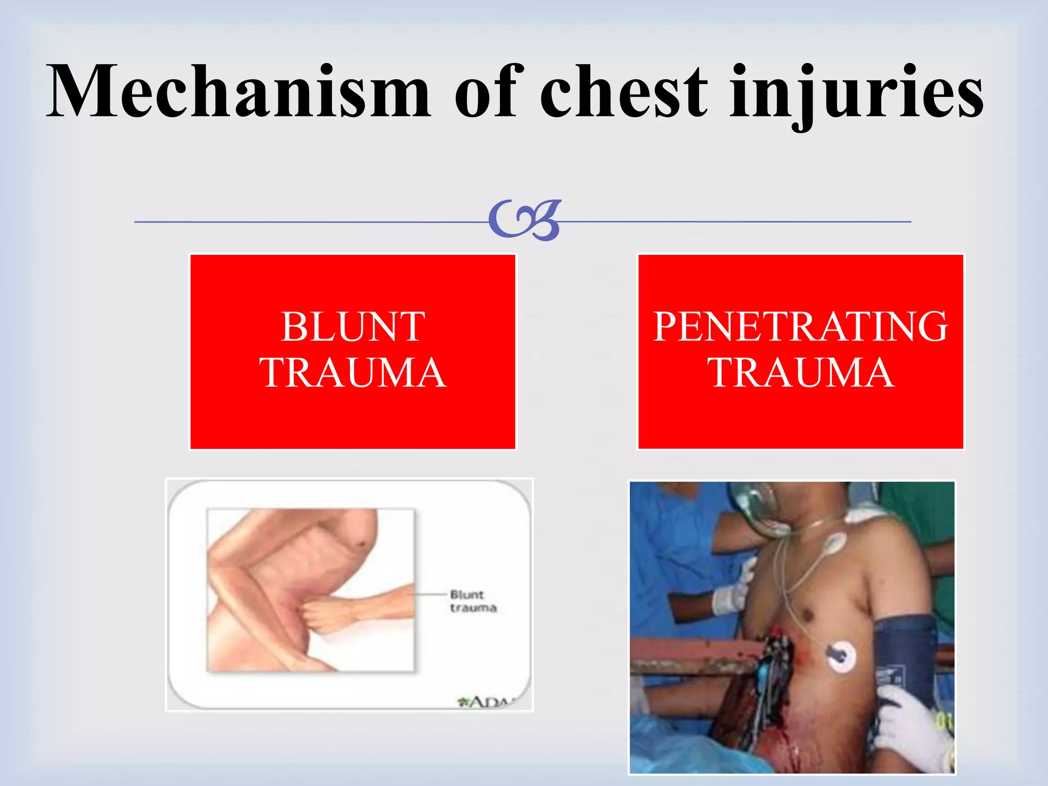 Chest injury | PPTX