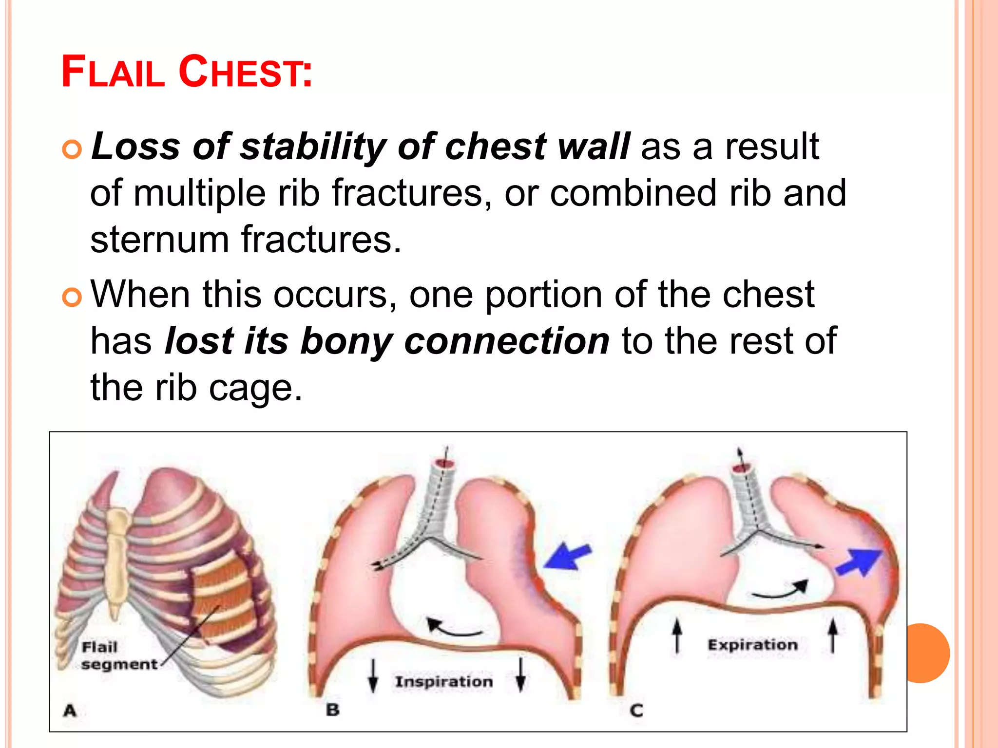 Chest injury and nursing care | PPTX