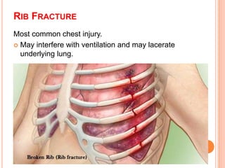 Chest injury and nursing care | PPTX