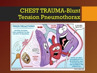 CHEST TRAUMA-Blunt
Tension Pneumothorax
 