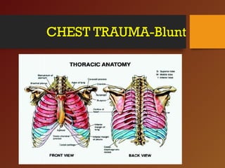 CHEST INJURY- BLUNT- Trauma Surgery | PPT