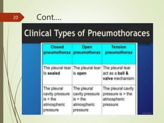 Cont.…
5/29/2023
20
 