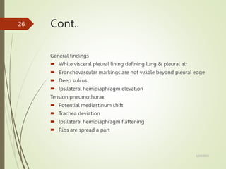 Cont..
General findings
 White visceral pleural lining defining lung & pleural air
 Bronchovascular markings are not visible beyond pleural edge
 Deep sulcus
 Ipsilateral hemidiaphragm elevation
Tension pneumothorax
 Potential mediastinum shift
 Trachea deviation
 Ipsilateral hemidiaphragm flattening
 Ribs are spread a part
5/29/2023
26
 