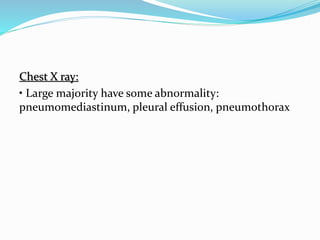 Chest X ray:
• Large majority have some abnormality:
pneumomediastinum, pleural effusion, pneumothorax
 