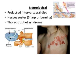 Neurological
• Prolapsed intervertebral disc
• Herpes zoster (Sharp or burning)
• Thoracic outlet syndrome
 